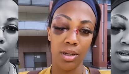 Ex-Olympian From PA Blinded After Jumped By Homeless Man (VIDEOS)