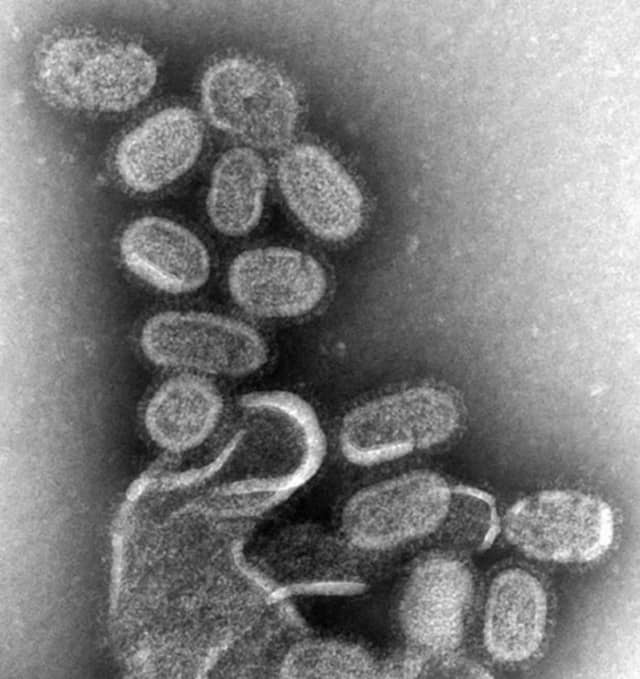 Influenza killed a New Jersey child last month