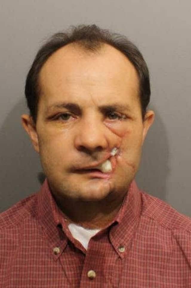 Charles Garcia, 47, of Wilton, has pleaded not guilty to two charges in connection with a shooting incident at his Grumman Avenue home. 